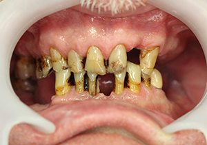 Before treatment